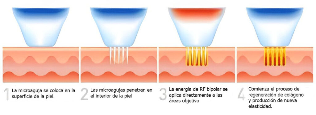 nanocamuflaje laser