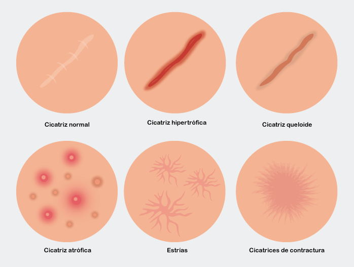 cicatrices en la cara