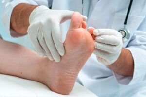 Prevenir y cuidar el pie diabético infectado