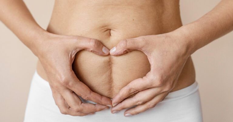 ChatGPT Plus Cicatriz abdominal vertical postquirúrgica en mujer, con manos formando corazón sobre la zona para tratamiento de cicatrices.