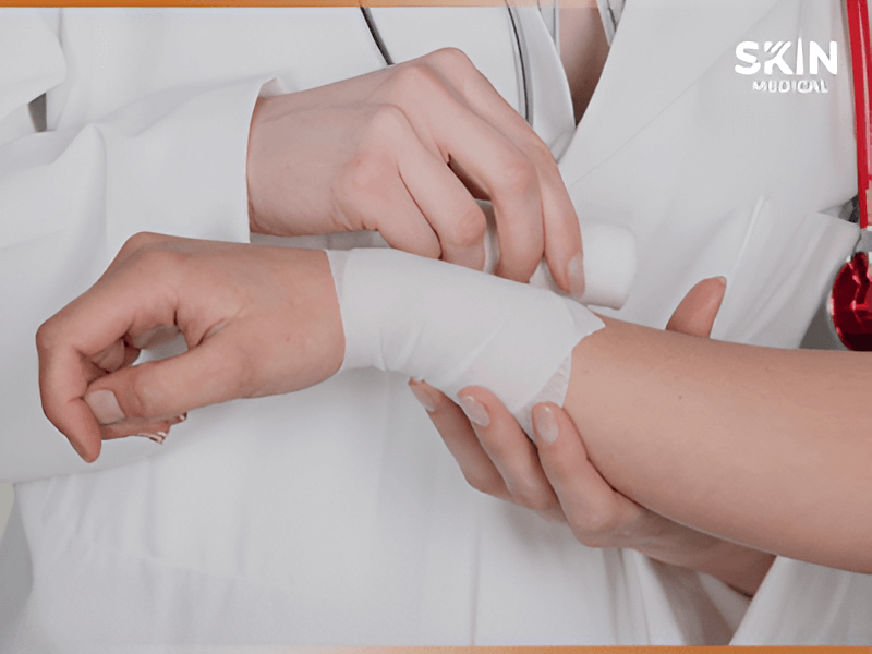 Profesional de salud realizando curación avanzada de herida en muñeca, aplicando vendaje estéril SkinMedical