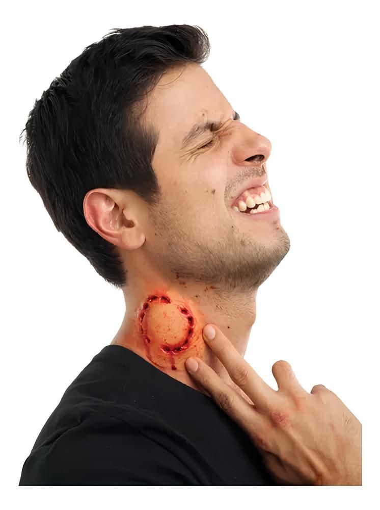 mordedura humana tratamiento