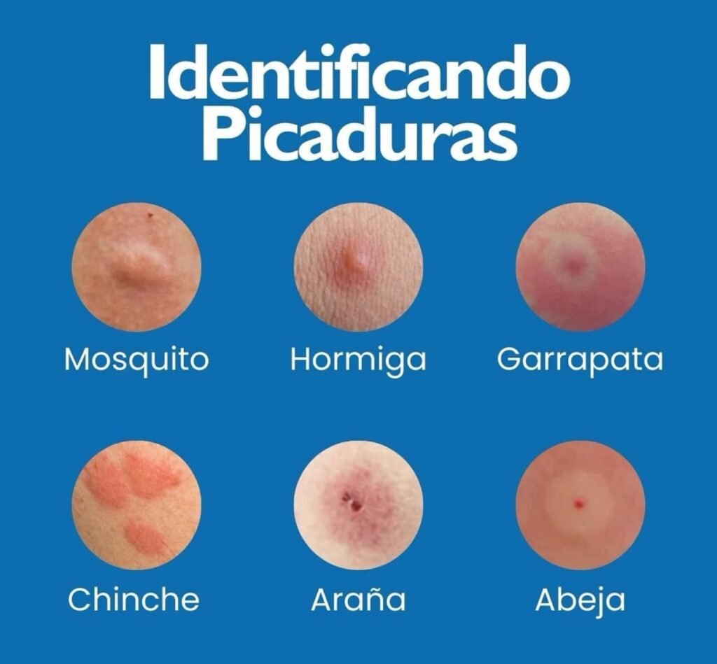 Identificación de picaduras de insectos: mosquito, hormiga, garrapata, chinche, araña y abeja.