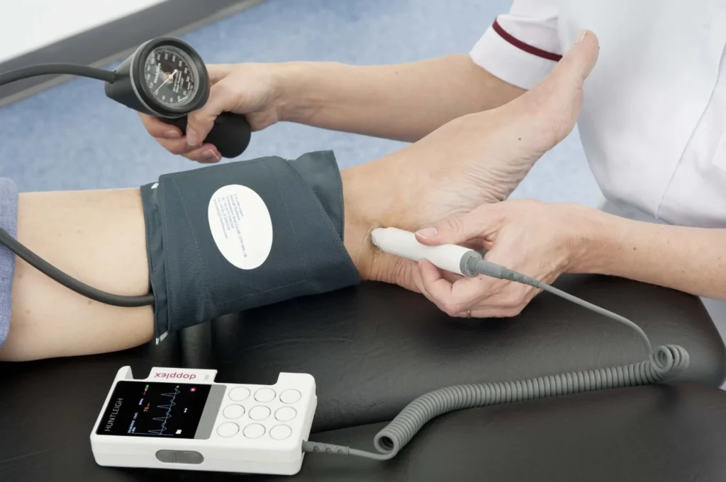 Evaluación doppler de la circulación en tobillo para prevención de pie diabético y úlceras en SkinMedical