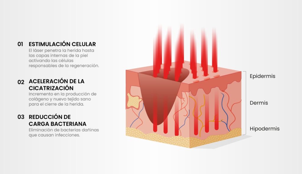 Regenerislaser skin Medical