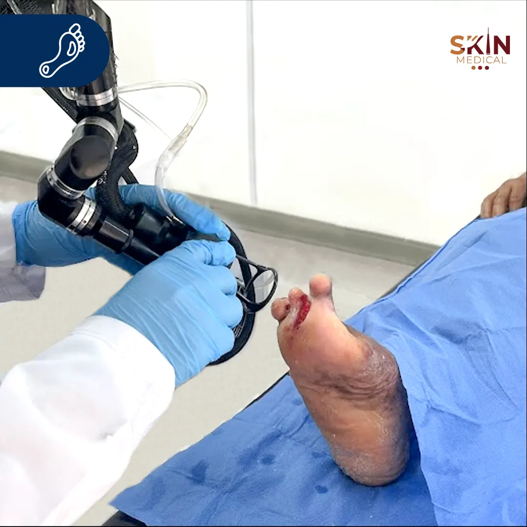 Tecnologías avanzadas para la recuperación de lesiones faciales​