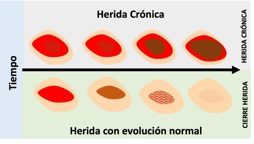 Síntomas principales de una herida crónica: inflamación, dolor y secreción