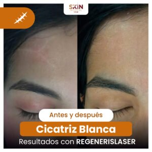NANO-ANTES-Y-DESPUES