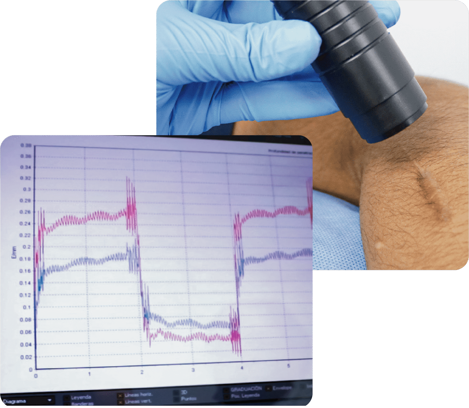 Especialistas en heridas aplicando técnicas avanzadas en Lima