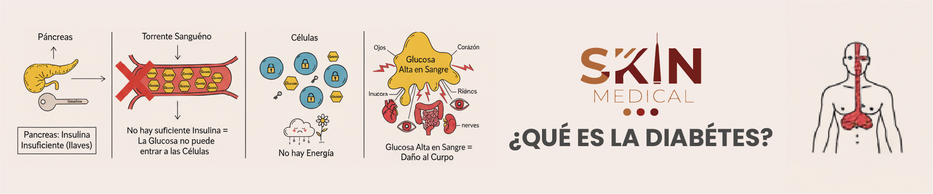 diabetes, que es y como tratarlo