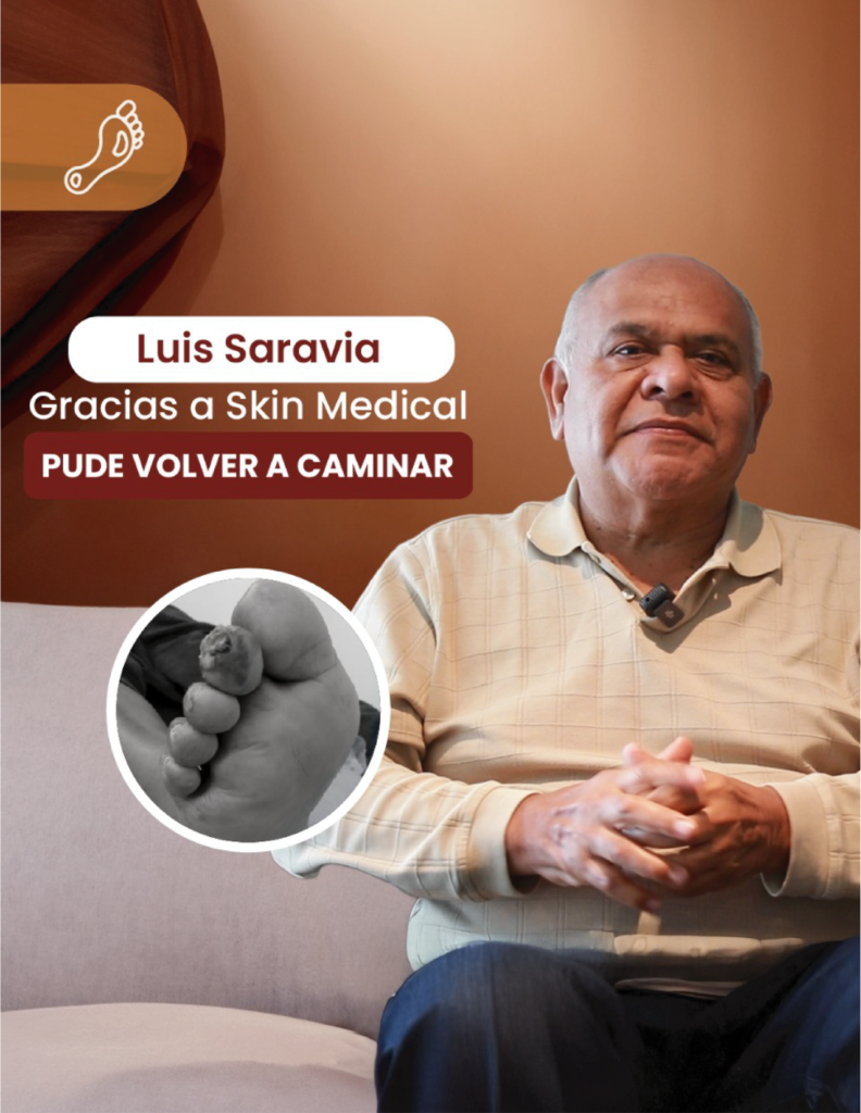 Caso de exito Pie diabetico 2025