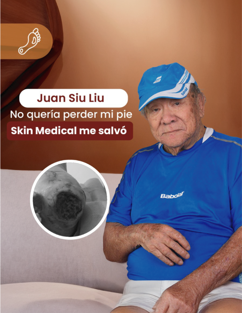 Caso de exito Pie diabetico 2025