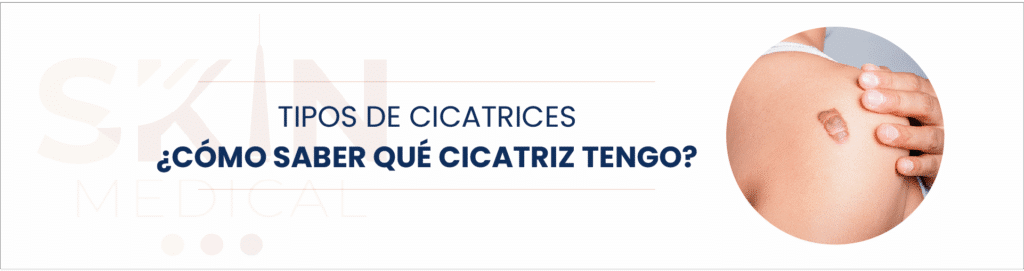 cicatriz