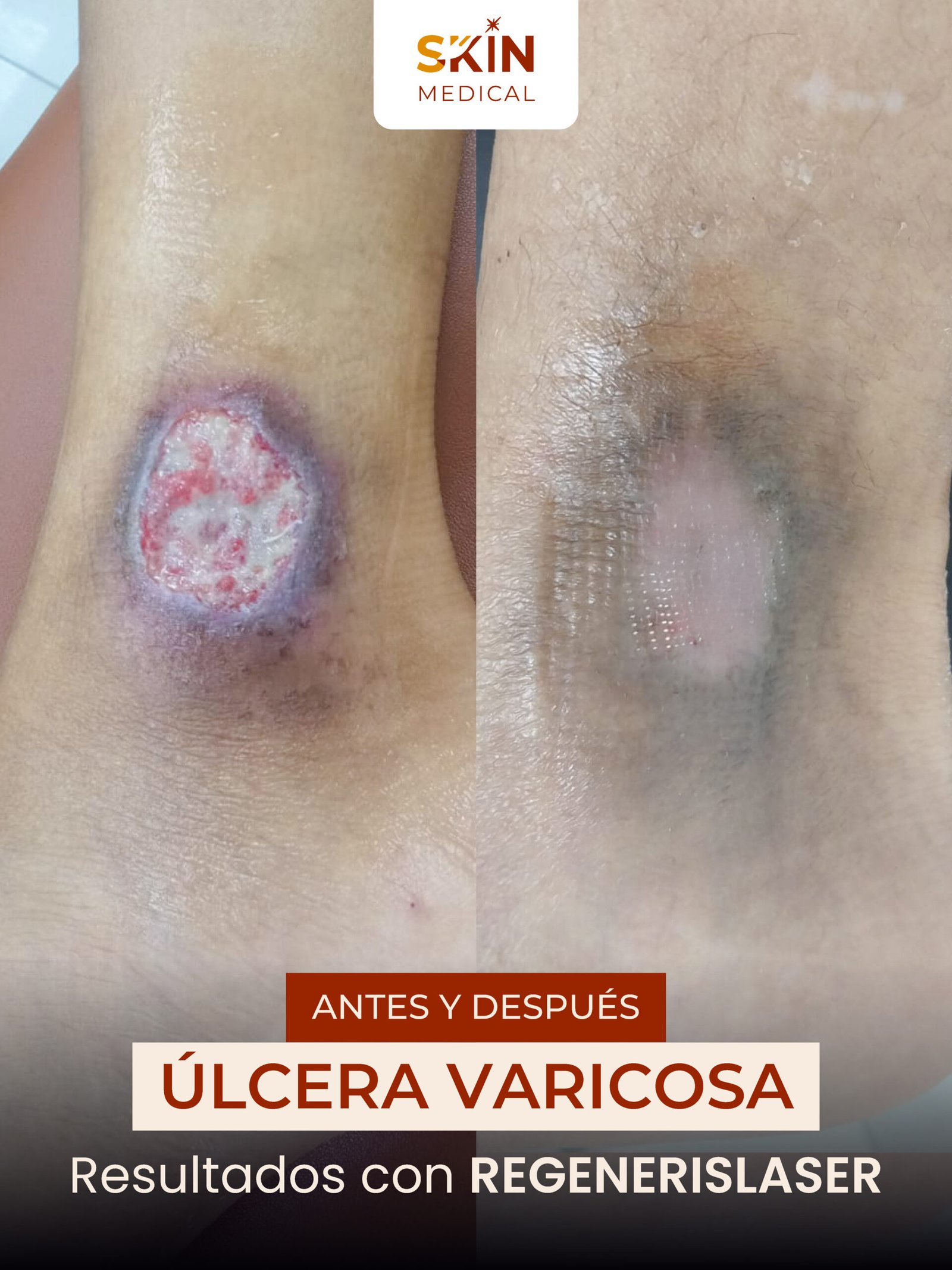 Antes y Después WEB CAMPAÑA-19.jpg