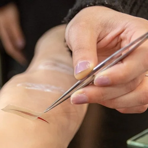 Qué factores retrasan el avance del tratamiento en heridas