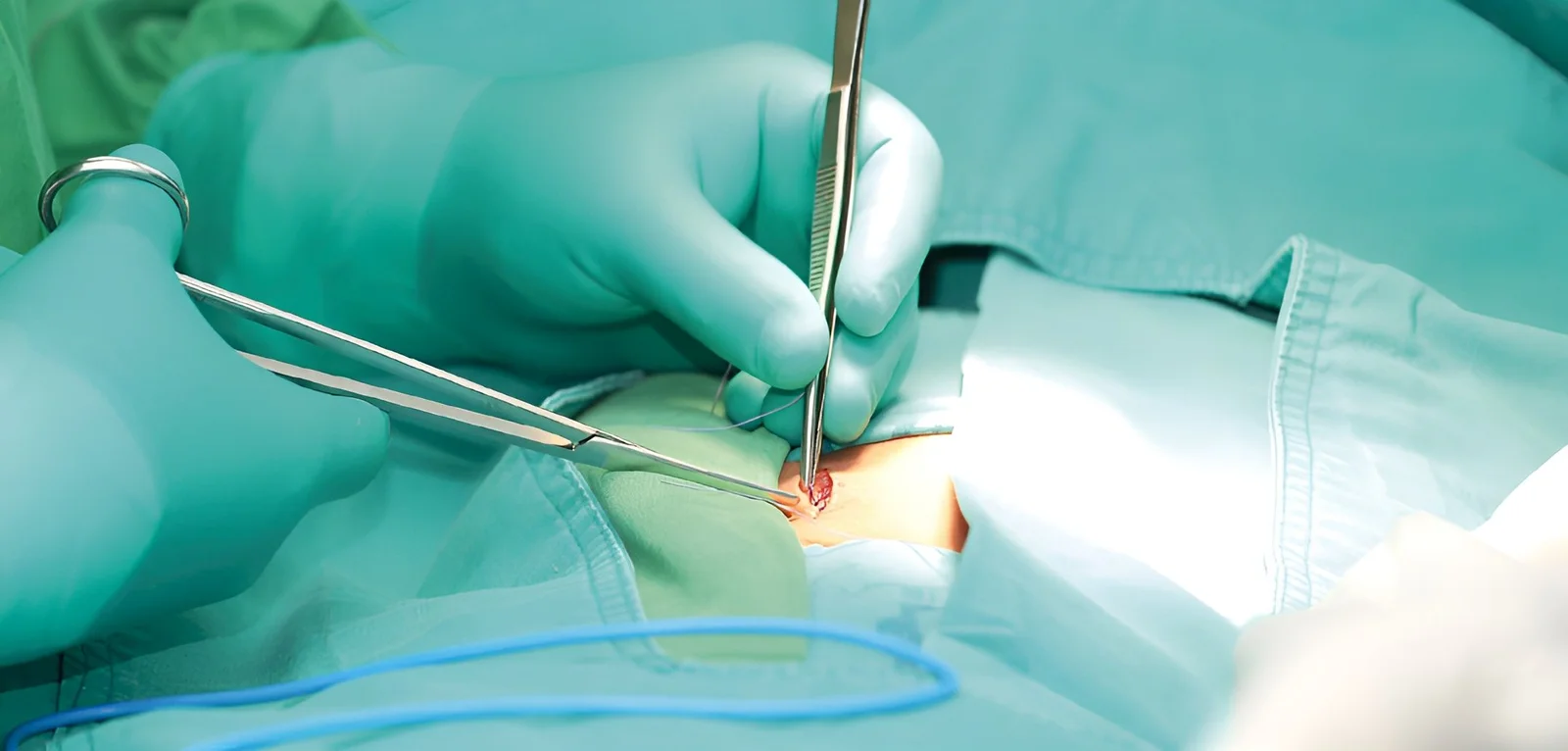 Curación de heridas quirúrgicas