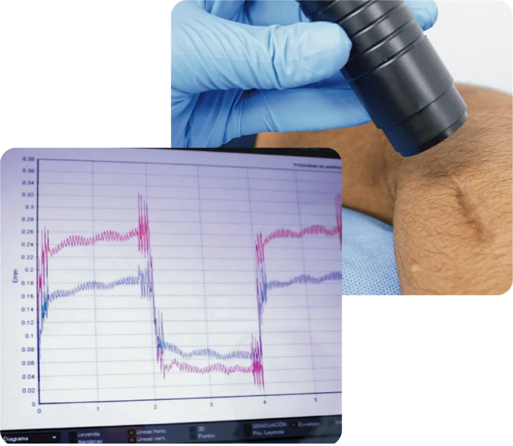 Especialistas en heridas aplicando técnicas avanzadas en Lima