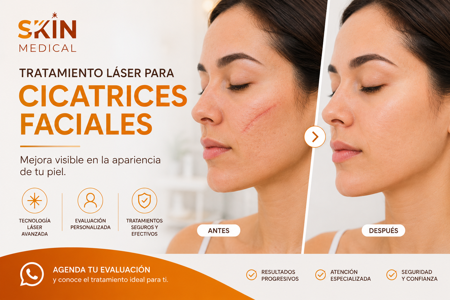 Antes y después del tratamiento de cicatrices faciales​