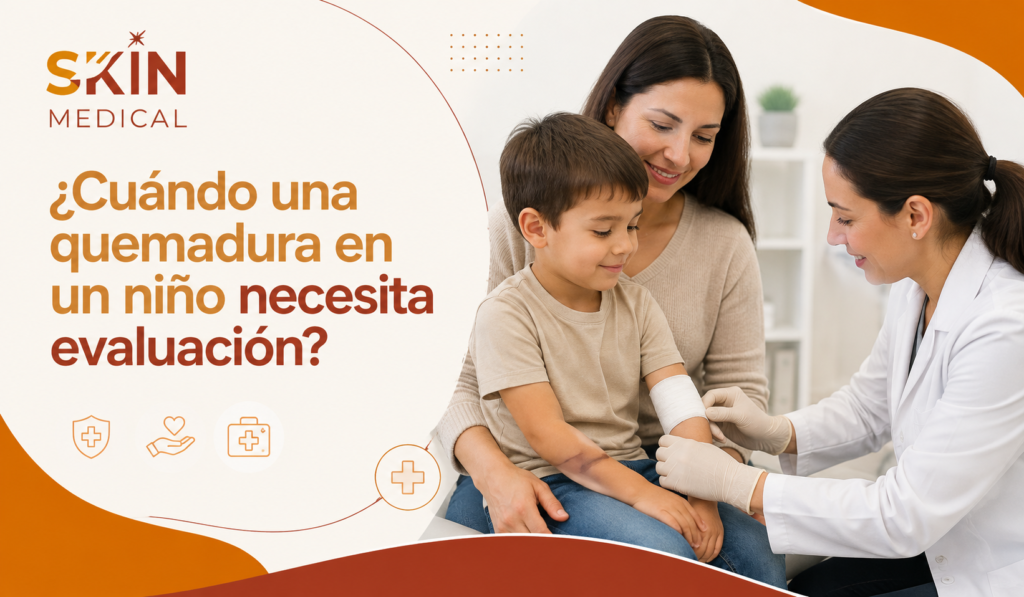 ¿Cuándo una quemadura en un niño necesita evaluación?