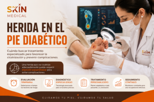evaluación especializada de herida en el pie diabético
