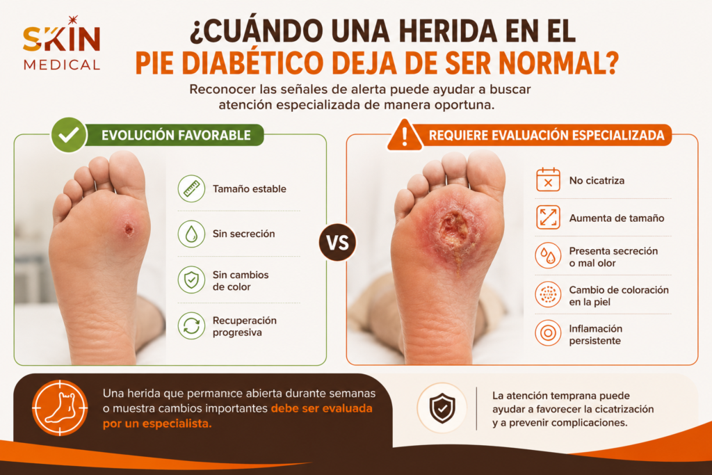 ¿Cuándo una herida en el pie diabético deja de ser normal?​