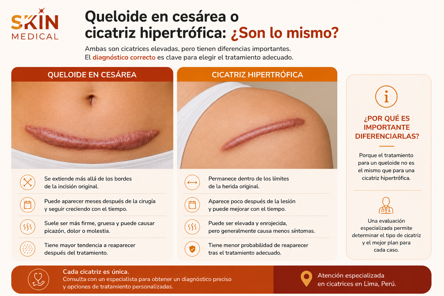 Queloide en cesárea o cicatriz hipertrófica: ¿Son lo mismo?