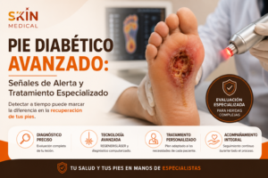 Pie Diabético Avanzado: Señales de Alerta y Tratamiento Especializado