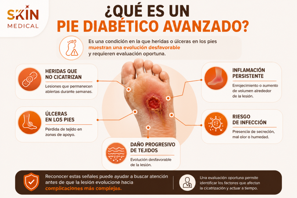 características de un pie diabético avanzado y señales de alerta