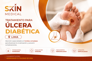 Tratamiento para Úlcera Diabética en Lima