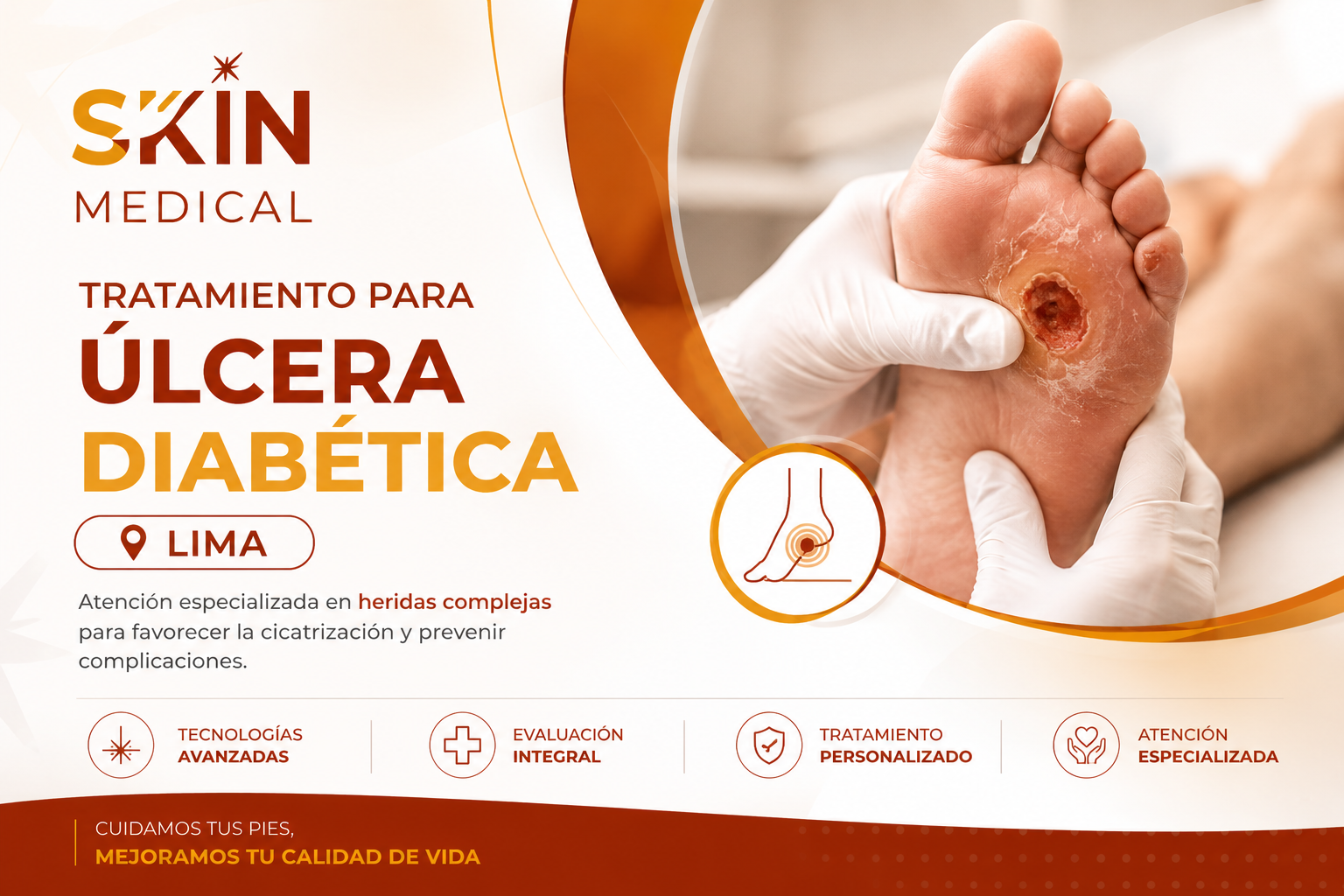 Tratamiento para Úlcera Diabética en Lima