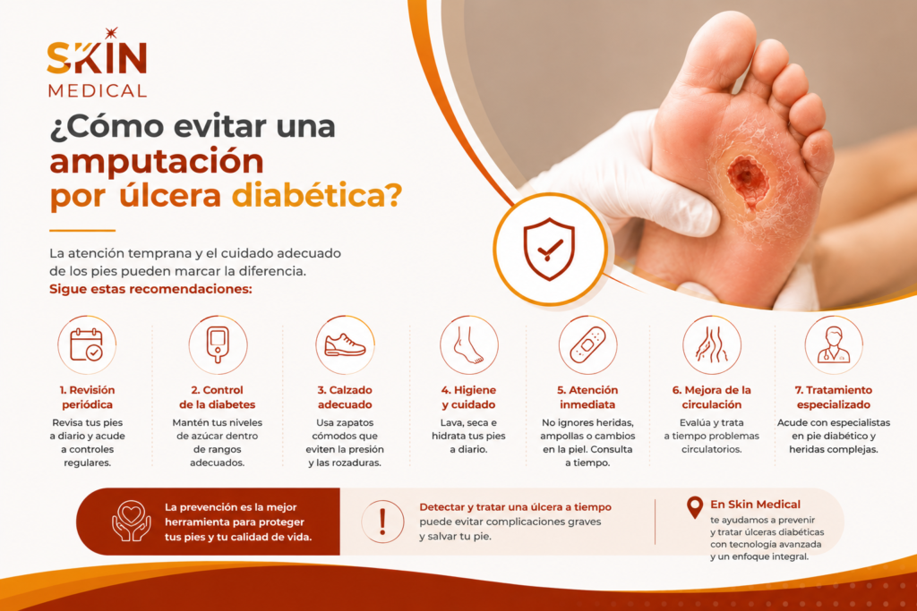 ¿Cómo evitar una amputación por úlcera diabética?