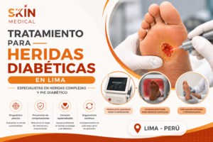 Tratamiento para Heridas Diabéticas en Lima