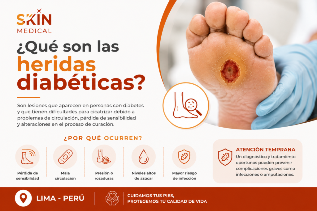 ¿Qué son las heridas diabéticas?​