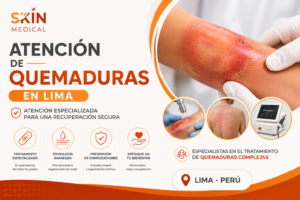 Atención de Quemaduras en Lima