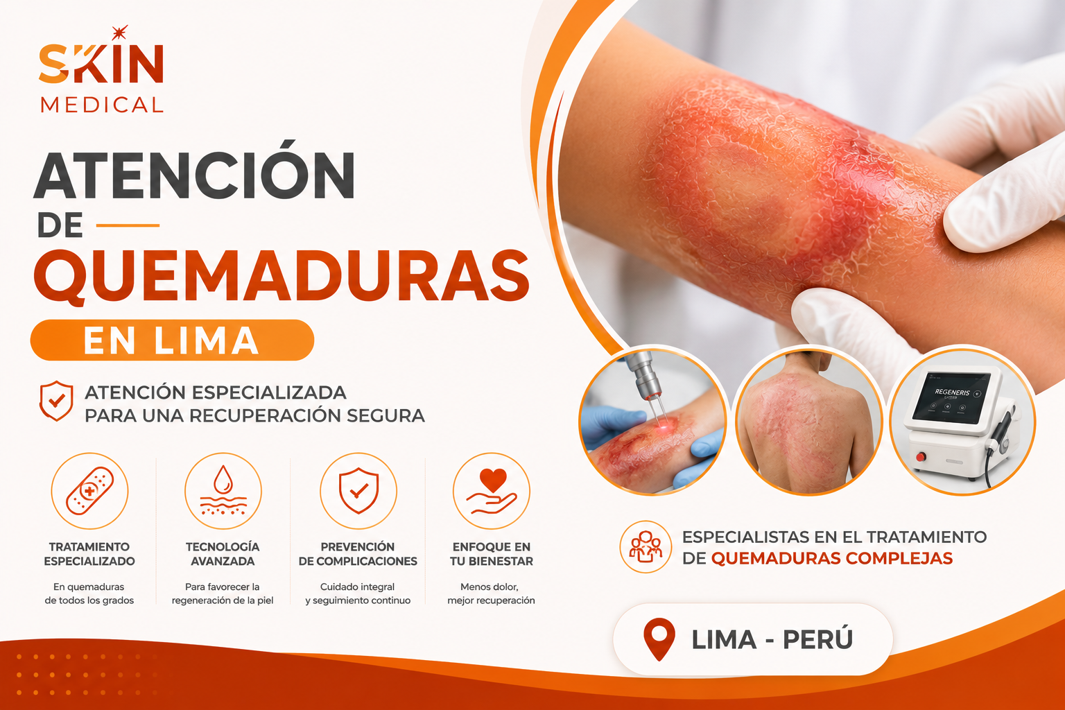 Atención de Quemaduras en Lima
