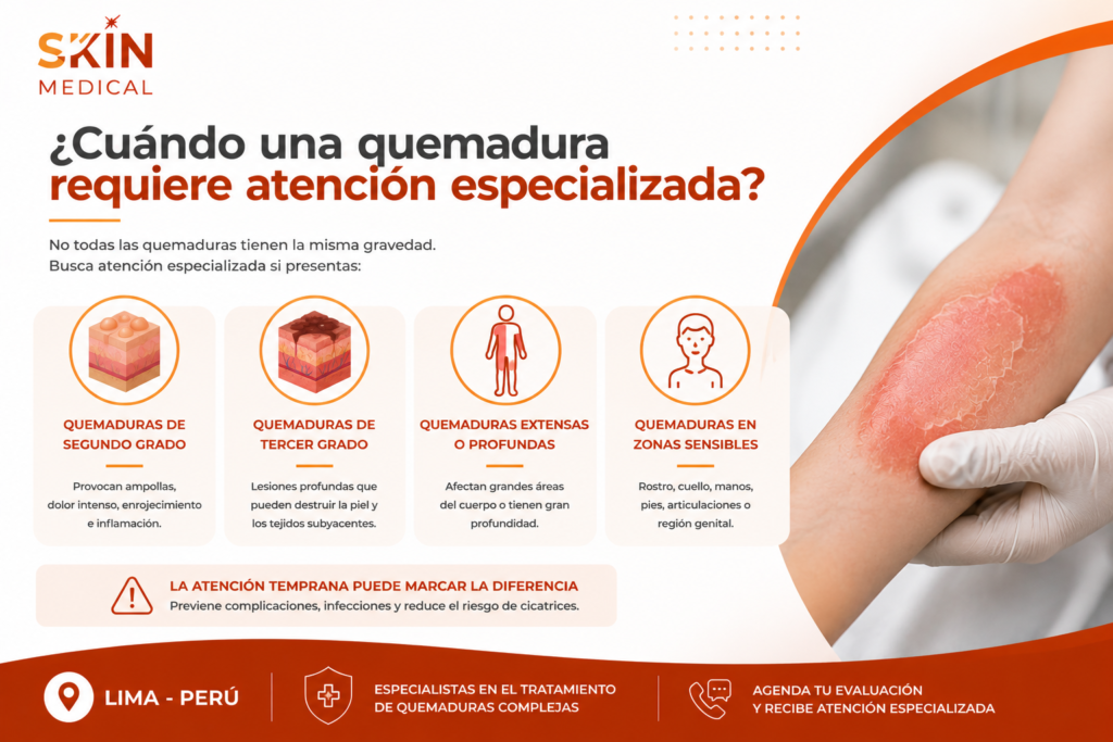 ¿Cuándo una quemadura requiere atención especializada?​