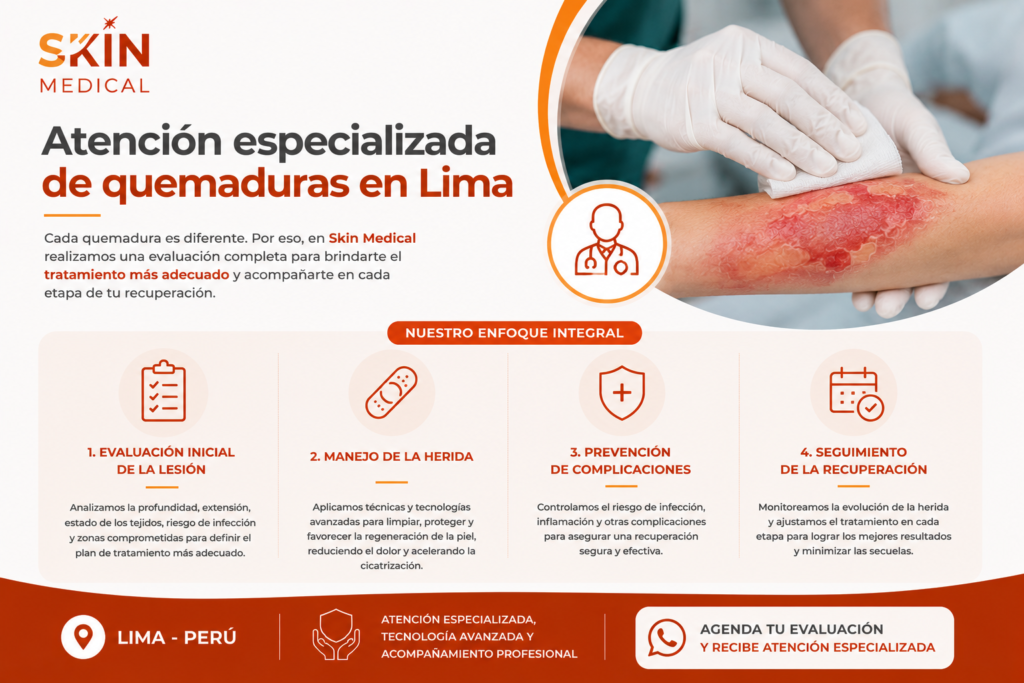 Atención especializada de quemaduras en Lima​
