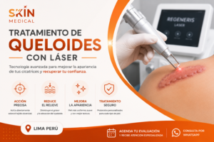 Tratamiento de Queloides con Láser