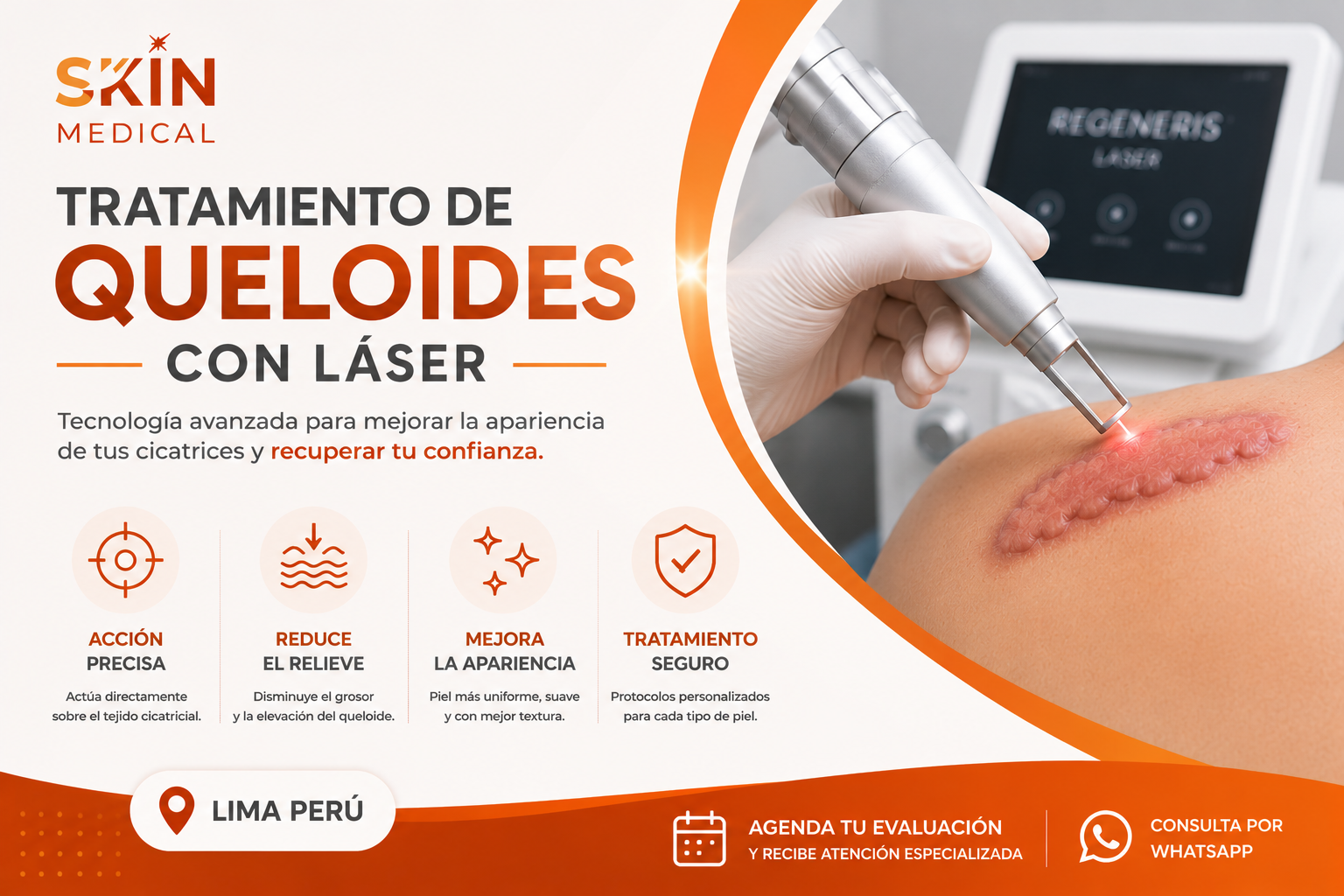 Tratamiento de Queloides con Láser
