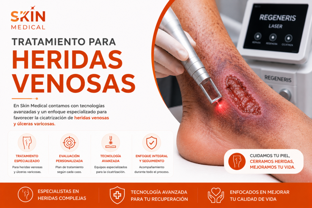 Tratamiento para Heridas Venosas