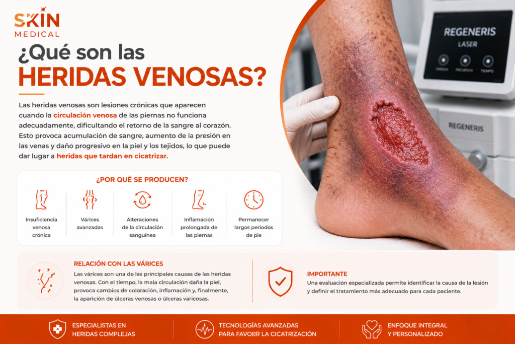 ¿Qué son las heridas venosas?​