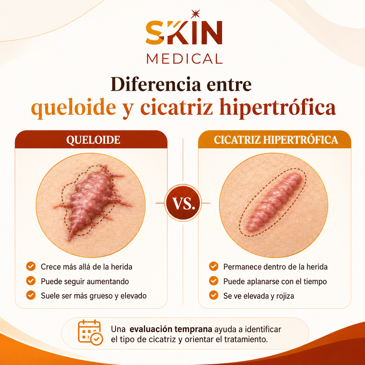 Diferencia entre queloide y cicatriz hipertrófica