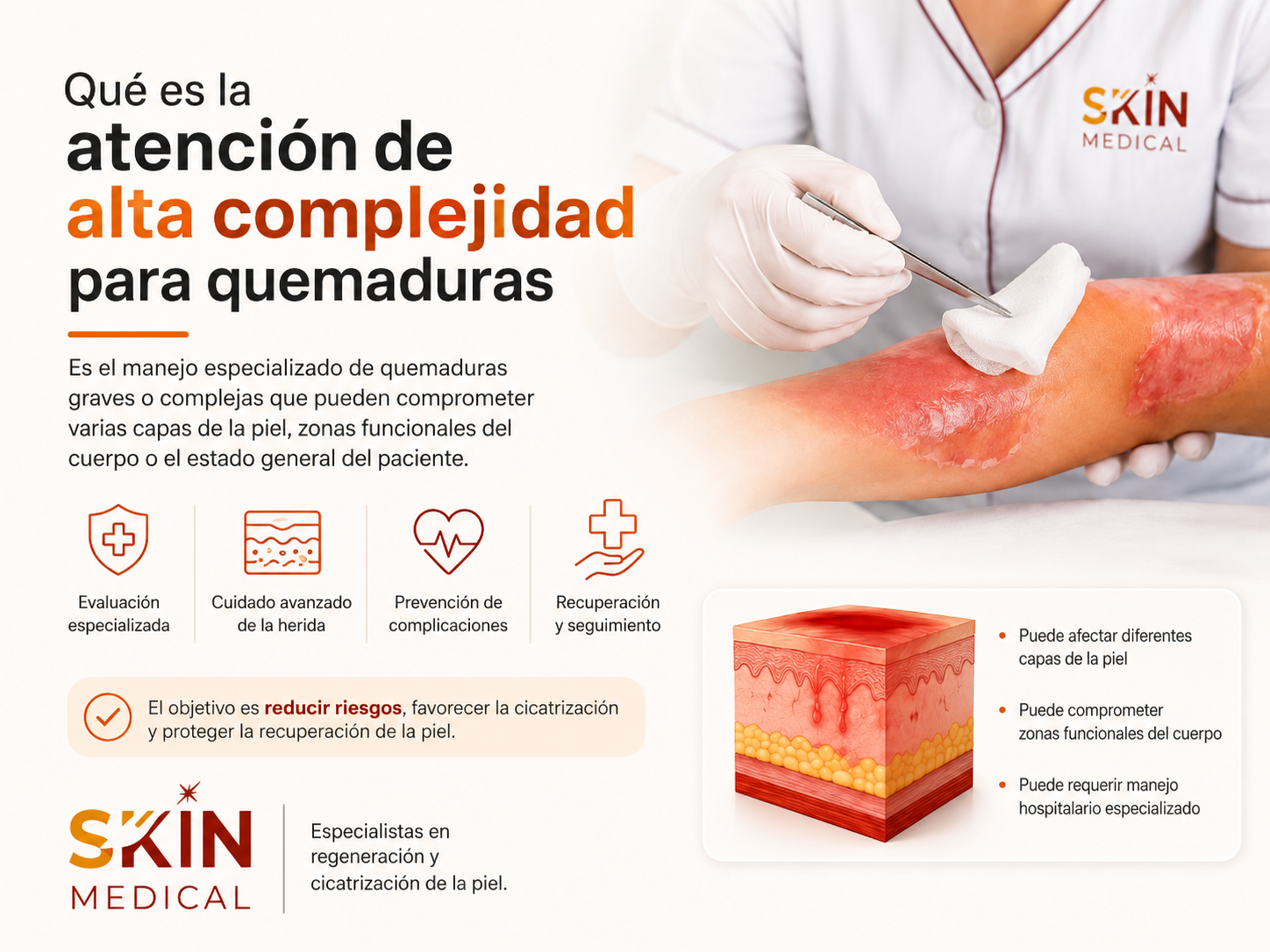 Qué es la atención de alta complejidad para quemaduras