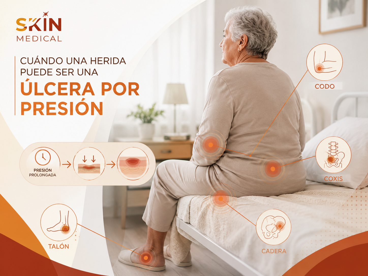 Cuándo una herida puede ser una úlcera por presión