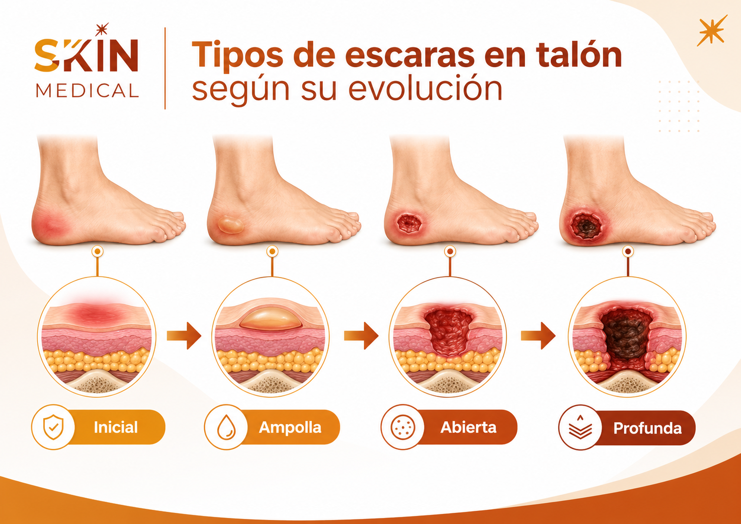 Tipos de escaras en talón según su evolución