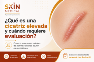 ¿Qué es una cicatriz elevada y cuándo requiere evaluación?