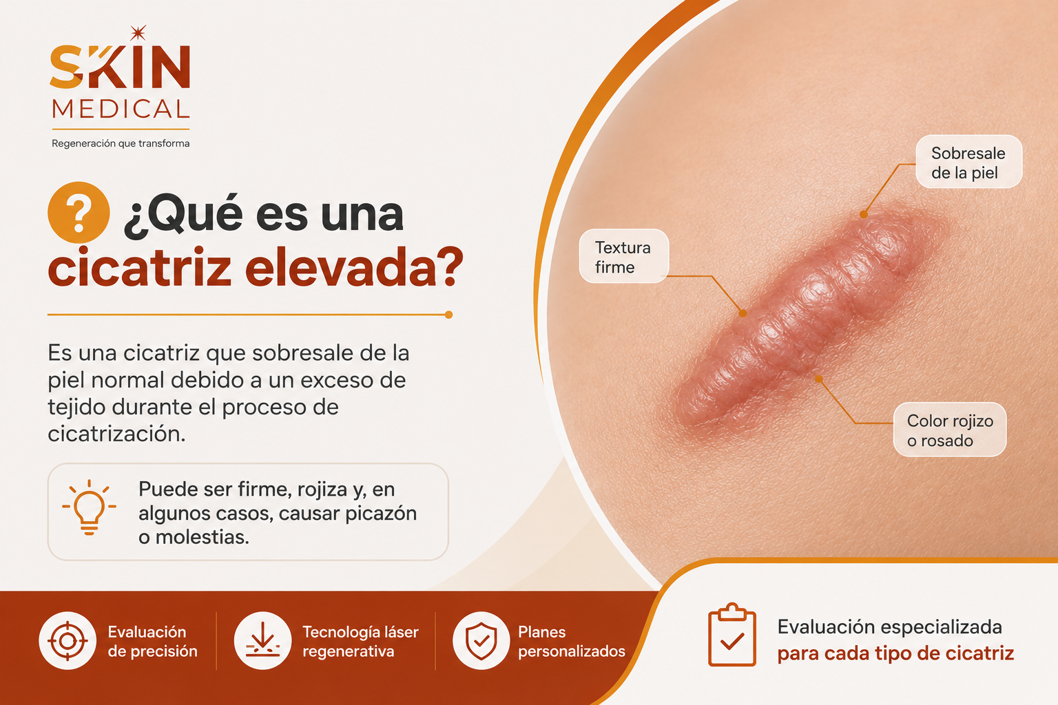 ¿Qué es una cicatriz elevada?