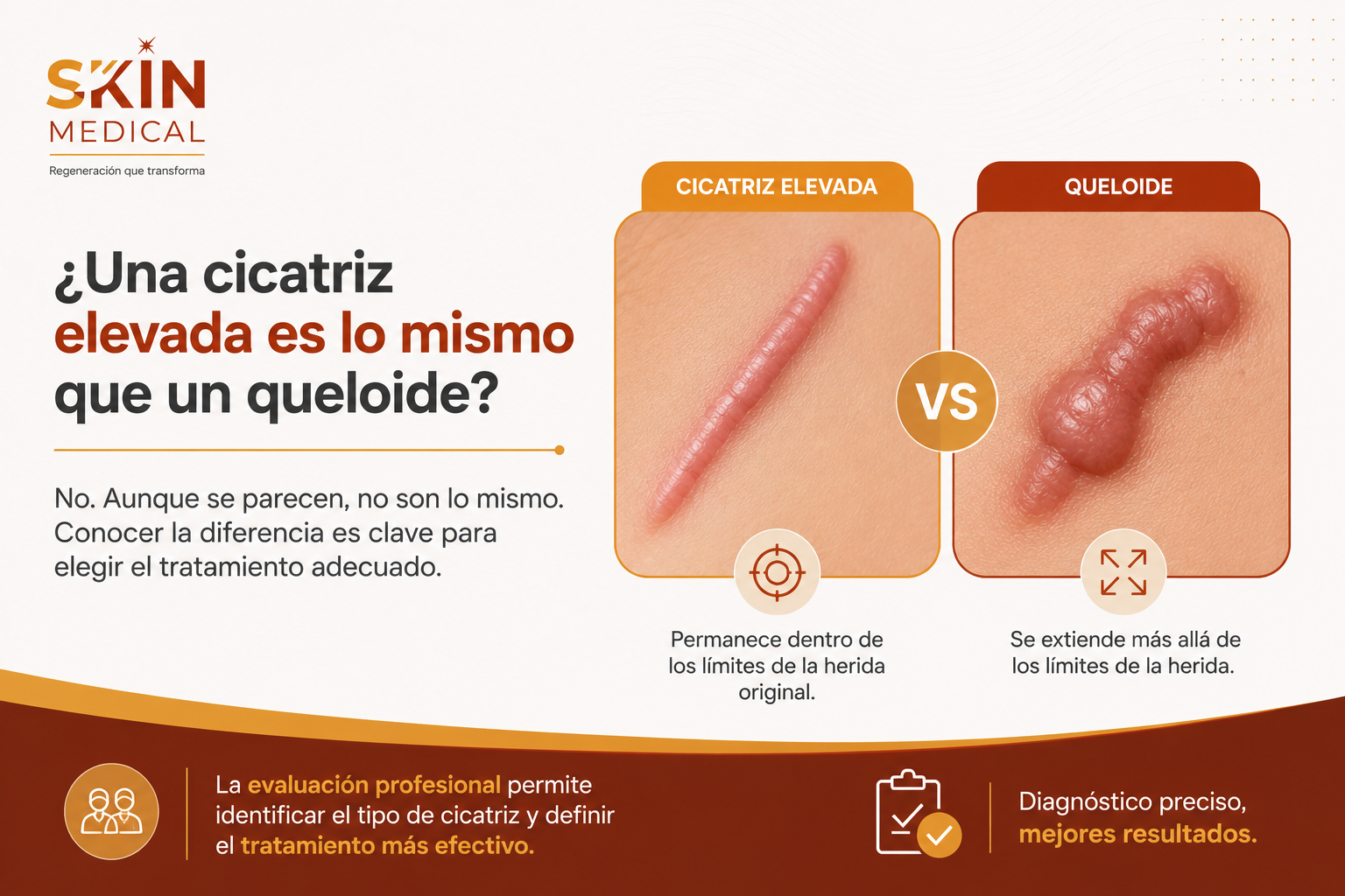 ¿Una cicatriz elevada es lo mismo que un queloide?