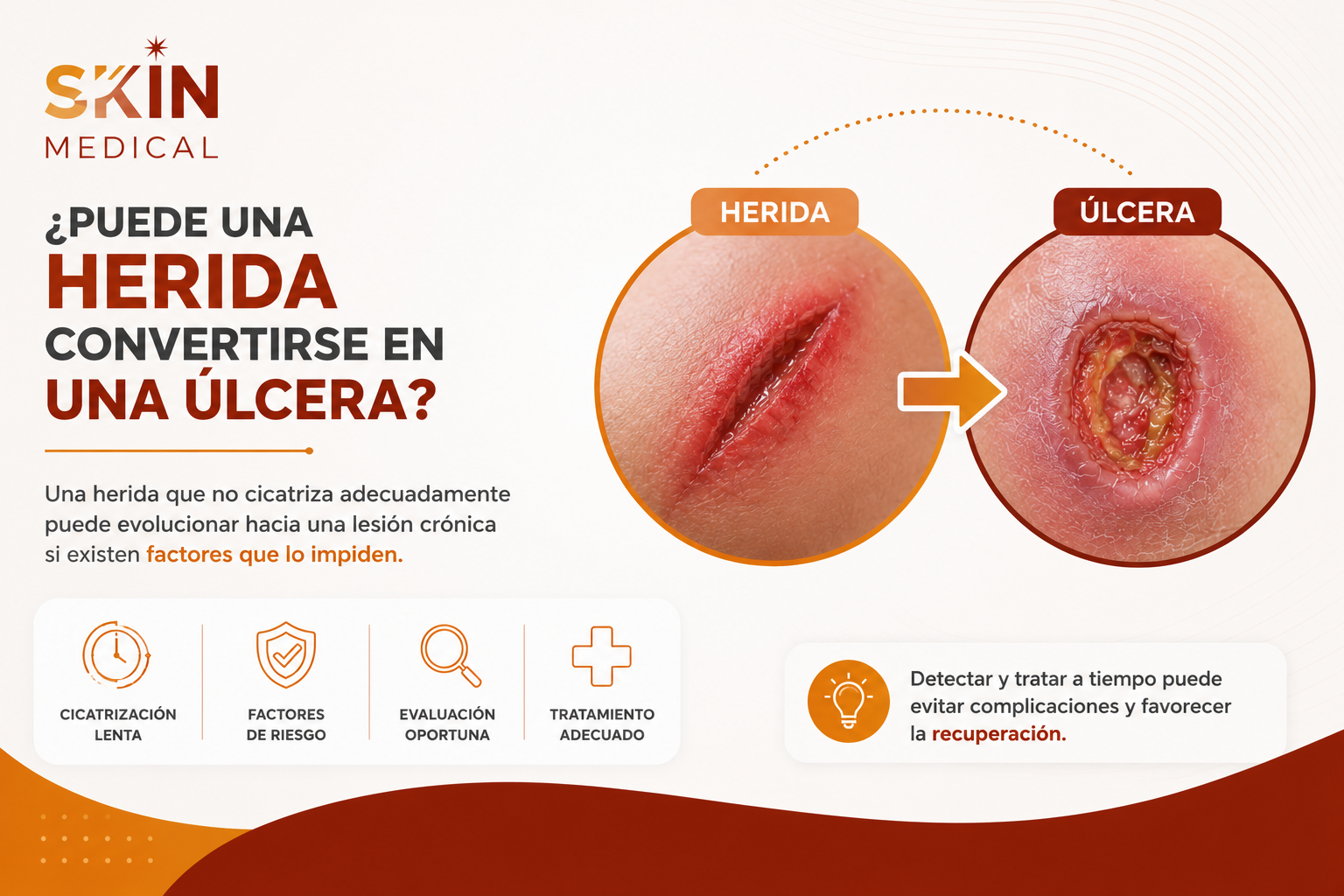 ¿Puede una herida convertirse en una úlcera?​