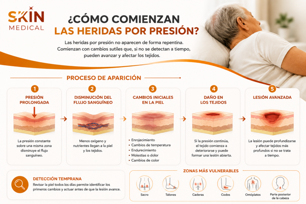 ¿Cómo comienzan las heridas por presión?